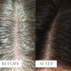 scalp reboot serum